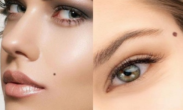 Sự thay đổi bất thường của nốt ruồi có thể cảnh báo bệnh K Sự thay đổi bất thường của nốt ruồi có thể cảnh báo bệnh K