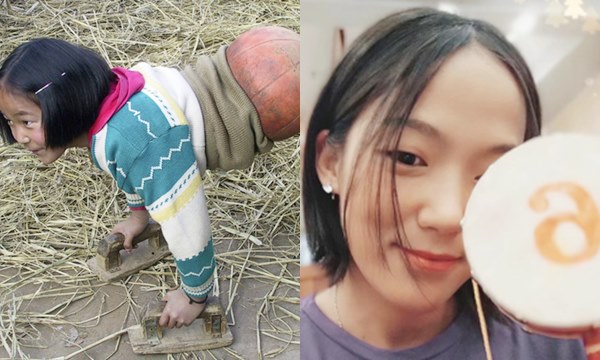 "Cô bé bóng rổ" không có thân dưới khiến cả thế giới nể phục năm xưa gây bất ngờ với cuộc sống và công việc ở thì hiện tại "Cô bé bóng rổ" không có thân dưới khiến cả thế giới nể phục năm xưa gây bất ngờ với cuộc sống và công việc ở thì hiện tại