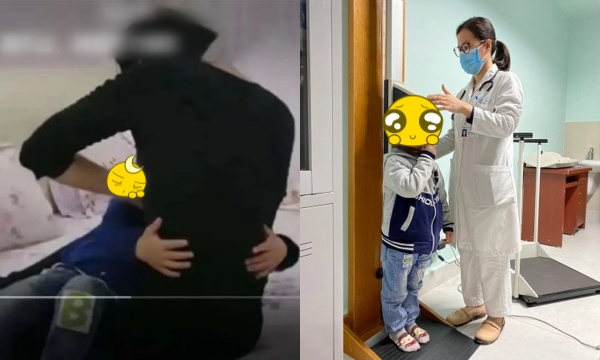 Bé trai 2 tuổi bỗng lớn nhanh như thổi, mọc l.ông vùng thân dưới Bé trai 2 tuổi bỗng lớn nhanh như thổi, mọc l.ông vùng thân dưới
