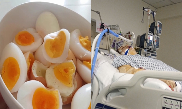 Mỗi ngày ăn 1 quả trứng, cô gái 26 tuổi được chẩn đoán mắc ung thư gan vì thói quen bảo quản thực phẩm sai cách mà nhiều người mắc phải